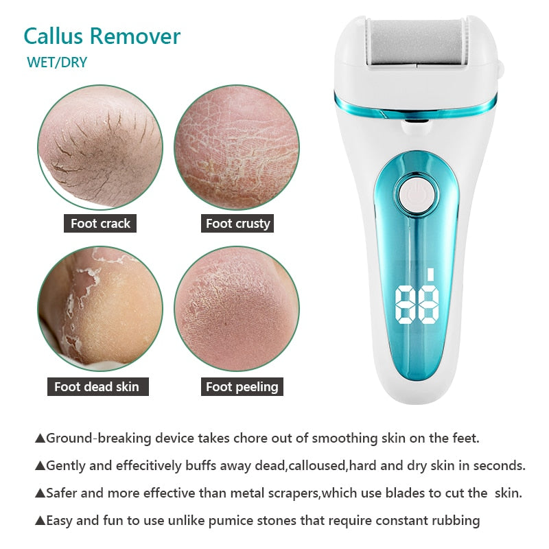 Rechargeable Battery Callus Remover Set FL01